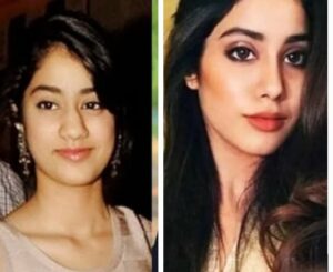 Janhvi Kapoor before and after surgery