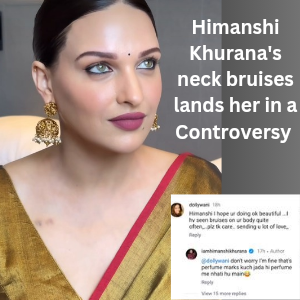 Himanshi Khurana neck bruises lands her in a Controversy